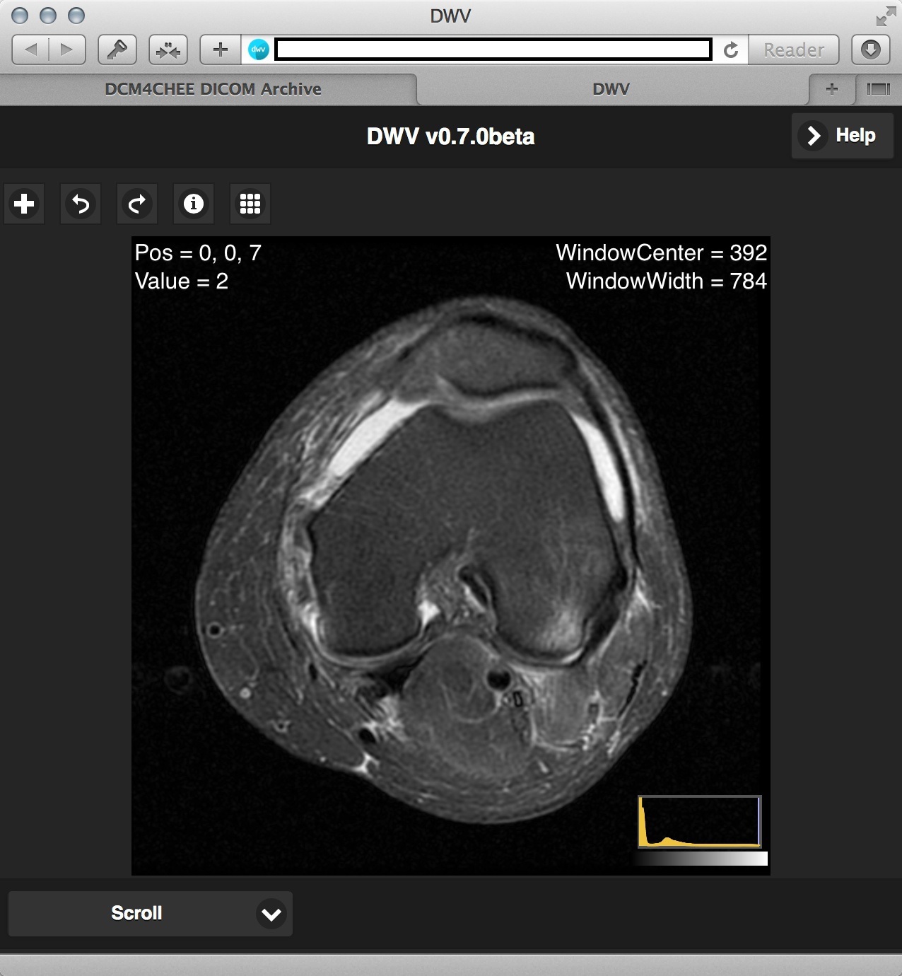 Dicom web viewer. Dicom. Dicom Формат. Dicom viewer. Симуляция Dicom.